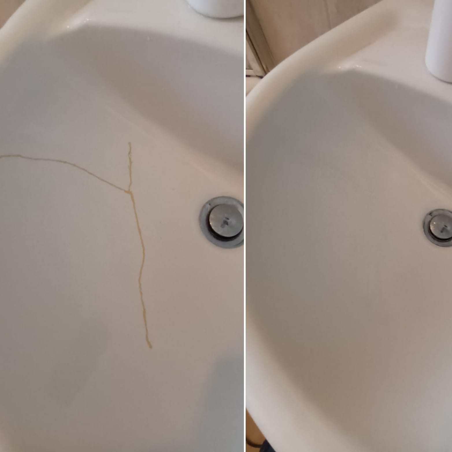 Before and after of a large crack repair in a white ceramic bathroom sink basin.